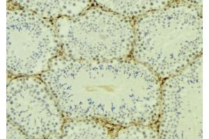 ABIN6276970 at 1/100 staining Mouse testis tissue by IHC-P. (POLI antibody  (N-Term))