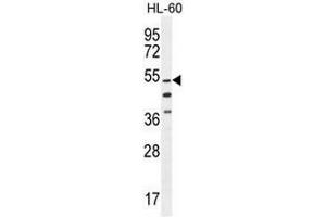 CO044 Antibody (C-term) western blot analysis in HL-60 cell line lysates (35µg/lane). (CO044 (AA 358-387), (C-Term) antibody)