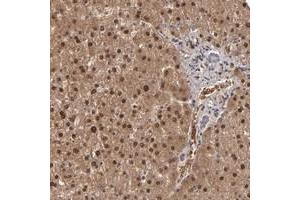 Immunohistochemical staining of human liver with ITIH4 polyclonal antibody  shows strong nuclear and cytoplasmic positivity in hepatocytes at 1:50-1:200 dilution. (ITIH4 antibody)