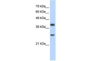 Human Jurkat; WB Suggested Anti-WDR39 Antibody Titration: 2. (CIAO1 antibody  (C-Term))