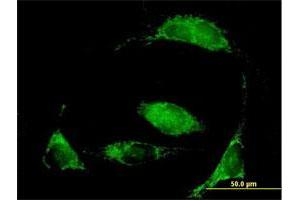 Immunofluorescence of purified MaxPab antibody to MCCC2 on HeLa cell. (MCCC2 antibody  (AA 1-563))