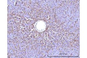 IHC analysis of RPS25 using anti-RPS25 antibody (ABIN7601567). (RPS25 antibody  (AA 39-125))