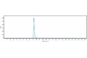 anti-PCSK9 (Lodelcizumab Biosimilar) antibody