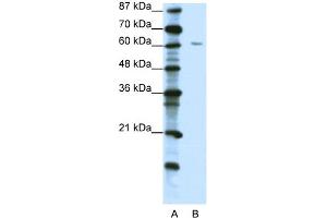 WB Suggested Anti-ZNF286 Antibody Titration:  1. (ZNF286A antibody  (C-Term))