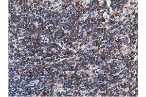 Image no. 9 for anti-Transforming, Acidic Coiled-Coil Containing Protein 3 (TACC3) antibody (ABIN1498095) (TACC3 antibody)