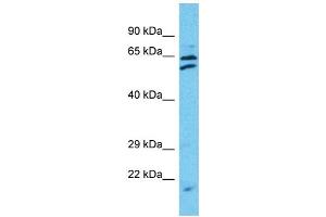 Western Blotting (WB) image for anti-Tetratricopeptide Repeat Domain 24 (TTC24) (C-Term) antibody (ABIN2791966) (TTC24 antibody  (C-Term))