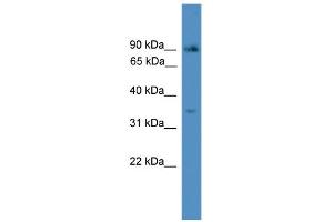 WB Suggested Anti-ING2 Antibody Titration:  0. (ING2 antibody  (N-Term))