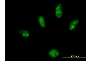 Immunofluorescence of purified MaxPab antibody to ZBTB25 on HeLa cell. (ZBTB25 antibody  (AA 1-435))