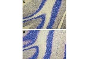Expression of ET-A in rat cerebellum - Immunohistochemical staining of rat cerebellum using Anti-Endothelin Receptor A Antibody (ABIN7043119, ABIN7044238 and ABIN7044239) (A), and Anti-Endothelin Receptor A  Antibody preincubated with the control peptide antigen (B). (Endothelin-1 Receptor antibody  (C-Term, Intracellular))