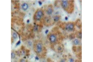 Used in DAB staining on fromalin fixed paraffin-embedded Liver tissue (TFPI antibody  (AA 29-251))