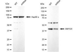 Western blotting analysis using SMYD3 antibody (ABIN7800322). (Recombinant SMYD3 antibody)