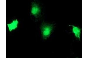 Anti-TBCC mouse monoclonal antibody (ABIN2455773) immunofluorescent staining of COS7 cells transiently transfected by pCMV6-ENTRY TBCC (RC203563). (TBCC antibody)