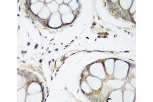 Immunohistochemistry of paraffin-embedded Human gastric using TAZ Polyclonal Antibody at dilution of 1:200 (40x lens). (TAZ antibody)
