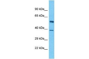 Host:  Rabbit  Target Name:  LUC7L3  Sample Type:  Pancreas Tumor lysates  Antibody Dilution:  1. (LUC7-Like 3 antibody  (Middle Region))