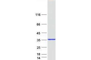 Validation with Western Blot