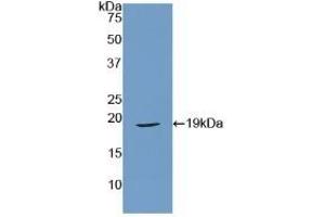 Detection of Recombinant RLN, Mouse using Polyclonal Antibody to Relaxin (RLN) (Relaxin antibody  (AA 25-181))