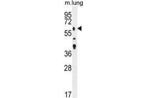 TGFBR2 Antibody (N-term) western blot analysis in mouse lung tissue lysates (35 µg/lane). (TGFBR2 antibody  (N-Term))