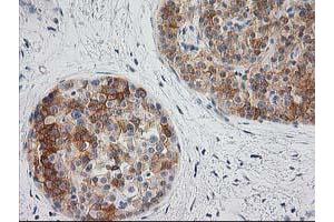 Image no. 7 for anti-BAI1-Associated Protein 2 (BAIAP2) antibody (ABIN1496805) (BAIAP2 antibody)