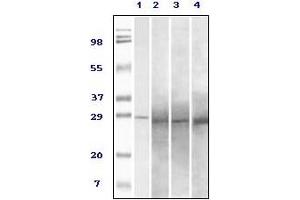 Western Blotting (WB) image for anti-RAB25, Member RAS Oncogene Family (RAB25) antibody (ABIN2464096) (RAB25 antibody)