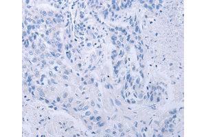 Immunohistochemistry (IHC) image for anti-Cyclin-Dependent Kinase 20 (CDK20) antibody (ABIN1871721)