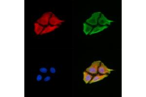 ABIN6259675 and ABIN6279158 staining HepG2 cells by IF/ICC.