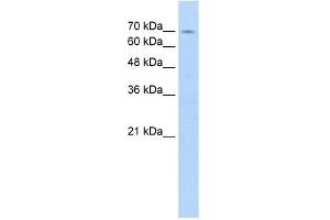 WB Suggested Anti-FBXL5 Antibody Titration:  5. (FBXL5 antibody  (Middle Region))