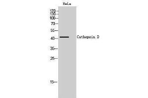 Western Blotting (WB) image for anti-Cathepsin D (CTSD) (Internal Region) antibody (ABIN3183691) (Cathepsin D antibody  (Internal Region))