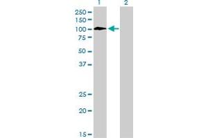 Western Blot analysis of TYRO3 expression in transfected 293T cell line by TYRO3 monoclonal antibody (M05), clone 4F6.