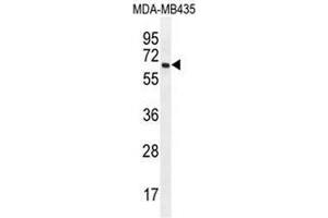 PRAMEF20 Antibody (C-term) western blot analysis in MDA-MB435 cell line lysates (35µg/lane). (PRAMEF20 antibody  (C-Term))