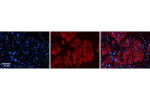 Rabbit Anti-Zfr Antibody  Catalog Number: ARP39226_P050 Formalin Fixed Paraffin Embedded Tissue: Human Adult heart  Observed Staining: Cytoplasmic Primary Antibody Concentration: 1:600 Secondary Antibody: Donkey anti-Rabbit-Cy2/3 Secondary Antibody Concentration: 1:200 Magnification: 20X Exposure Time: 0.