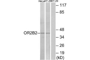 Western blot analysis of extracts from HeLa cells and HT-29 cells, using OR2B2 antibody. (OR2B2 antibody  (Internal Region))