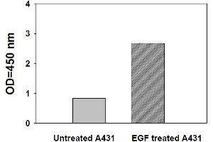 Image no. 3 for Signal Transducer and Activator of Transcription 6, Interleukin-4 Induced (STAT6) ELISA Kit (ABIN1981731)