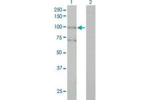 Western Blot analysis of ALS2 expression in transfected 293T cell line by ALS2 monoclonal antibody (M01), clone 4F9. (ALS2 antibody  (AA 221-320))