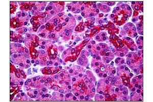 Human Pancreas: Formalin-Fixed, Paraffin-Embedded (FFPE) (PARL antibody  (N-Term))