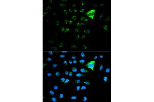 Immunofluorescence analysis of MCF-7 cells using CDKN1A antibody. (p21 antibody)