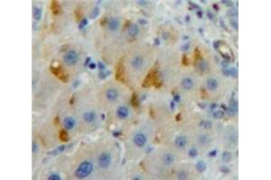 #VALUE! (LILRB3 antibody  (AA 410-631))