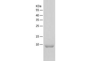 Western Blotting (WB) image for Epithelial Mitogen (EPGN) (AA 24-95) protein (His tag) (ABIN7122807) (Epigen Protein (AA 24-95) (His tag))