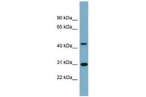 ARMCX3 antibody used at 0. (ARMCX3 antibody  (Middle Region))