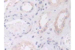 Detection of GLS in Human Kidney Tissue using Polyclonal Antibody to Glutaminase (GLS) (Glutaminase antibody  (AA 221-533))