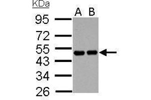 WB Image RCC1 antibody detects RCC1 protein by Western blot analysis. (RCC1 antibody)