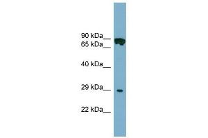 CYB5D1 antibody used at 1 ug/ml to detect target protein. (CYB5D1 antibody  (Middle Region))