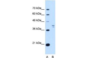 PSAT1 antibody used at 1 ug/ml to detect target protein. (PSAT1 antibody  (N-Term))