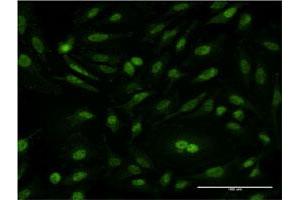Immunofluorescence of monoclonal antibody to CSE1L on HeLa cell. (Exportin 2 antibody  (AA 872-971))