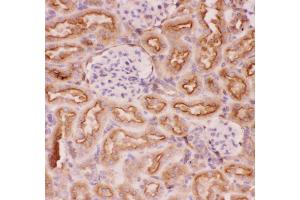 Anti-P Glycoprotein Picoband antibody,  IHC(P): Rat Kidney Tissue (ABCB1 antibody  (Middle Region))