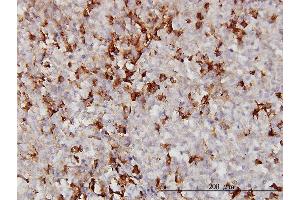 Immunoperoxidase of monoclonal antibody to APOA2 on formalin-fixed paraffin-embedded human malignant lymphoma, diffuse large B. (APOA2 antibody  (AA 1-100))