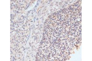Immunohistochemistry (Paraffin-embedded Sections) (IHC (p)) image for anti-Signal Transducer and Activator of Transcription 1, 91kDa (STAT1) (pSer727) antibody (ABIN7265092)