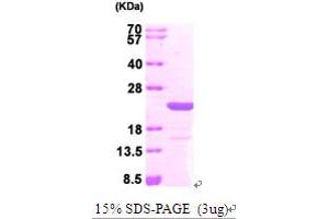 MAX Protein (AA 1-160) (His tag)