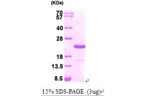 MAX Protein (AA 1-160) (His tag)