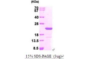 SDS-PAGE (SDS) image for MYC Associated Factor X (MAX) (AA 1-160) protein (His tag) (ABIN666983)