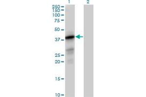 PTPLAD1 anticorps  (AA 1-362)
